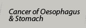 Cancer of Oesophagus & Stomach - Dr. Dhan Thiruchelvam